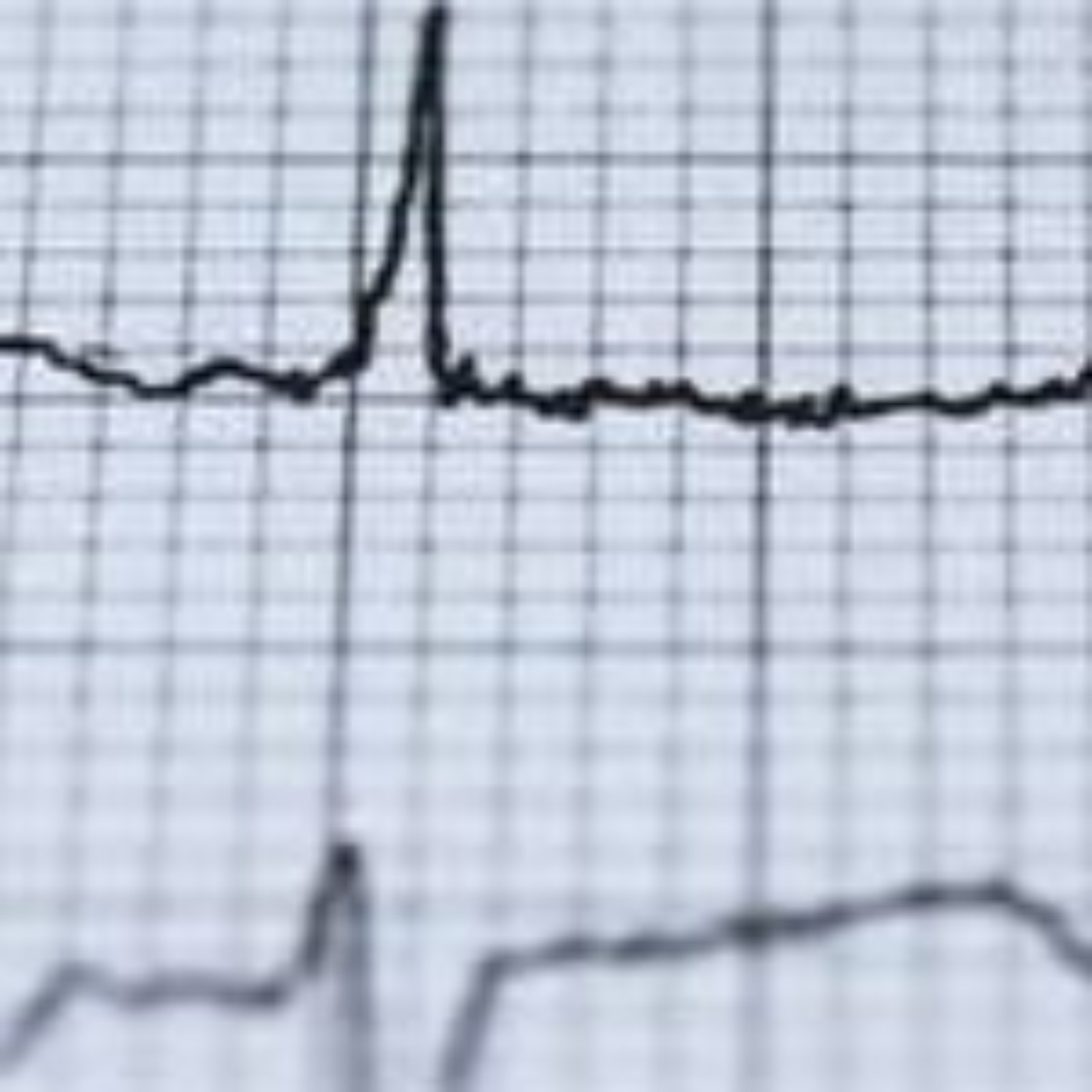 <?php echo pulse_output(); ?>